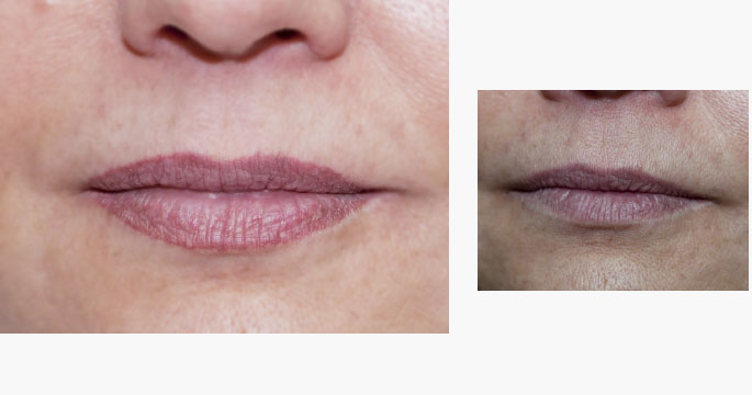 Permanent Lip Liner