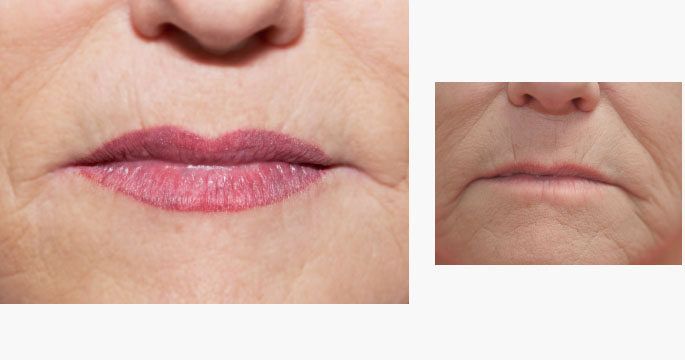 What Is Lip Blushing?- Permanent Lip Blush Tattoo Before/After
