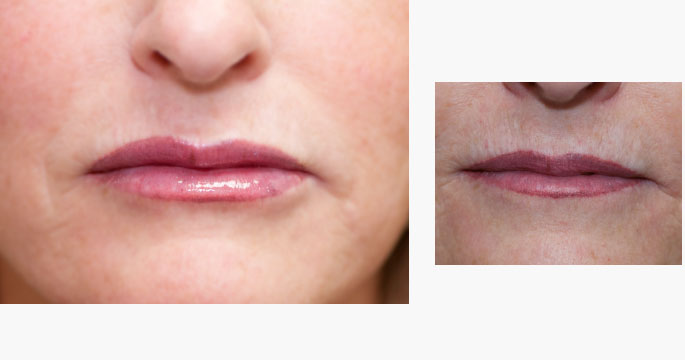 Permanent Lip Liner